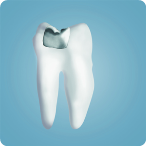Amalgam