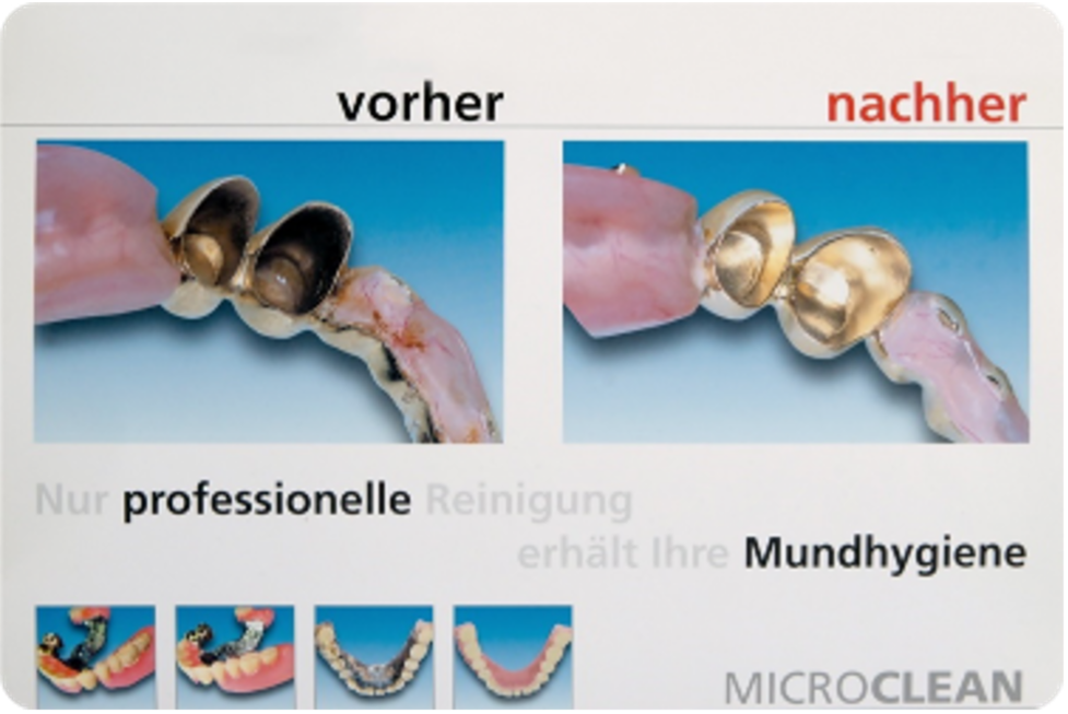 Prothesen-Reinigung Prothesen-Reinigung